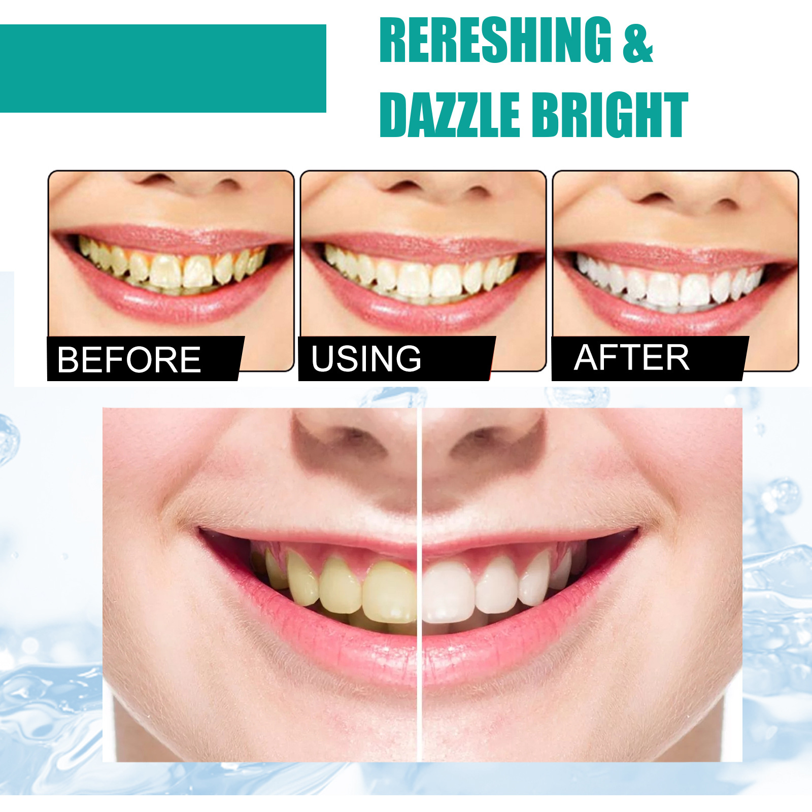 Мятный зубной порошок Свежее д – обзор и цена Teeth Whitening Near Me