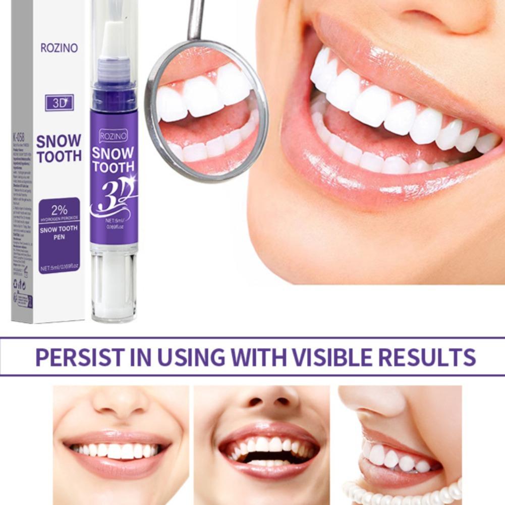 3D-ручка для отбеливания зубов – обзор и цена Teeth Whitening Near Me